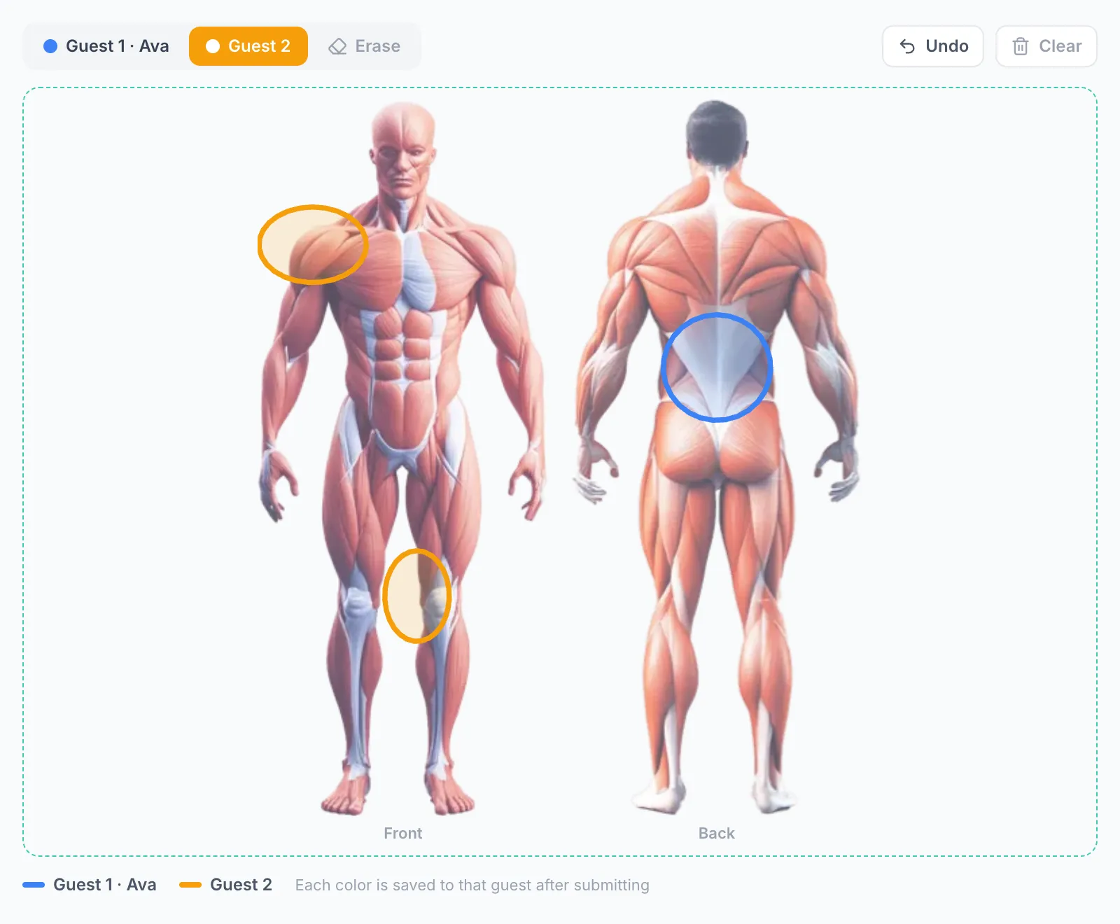 The couple check-in form with blue and orange pen marks on one body diagram