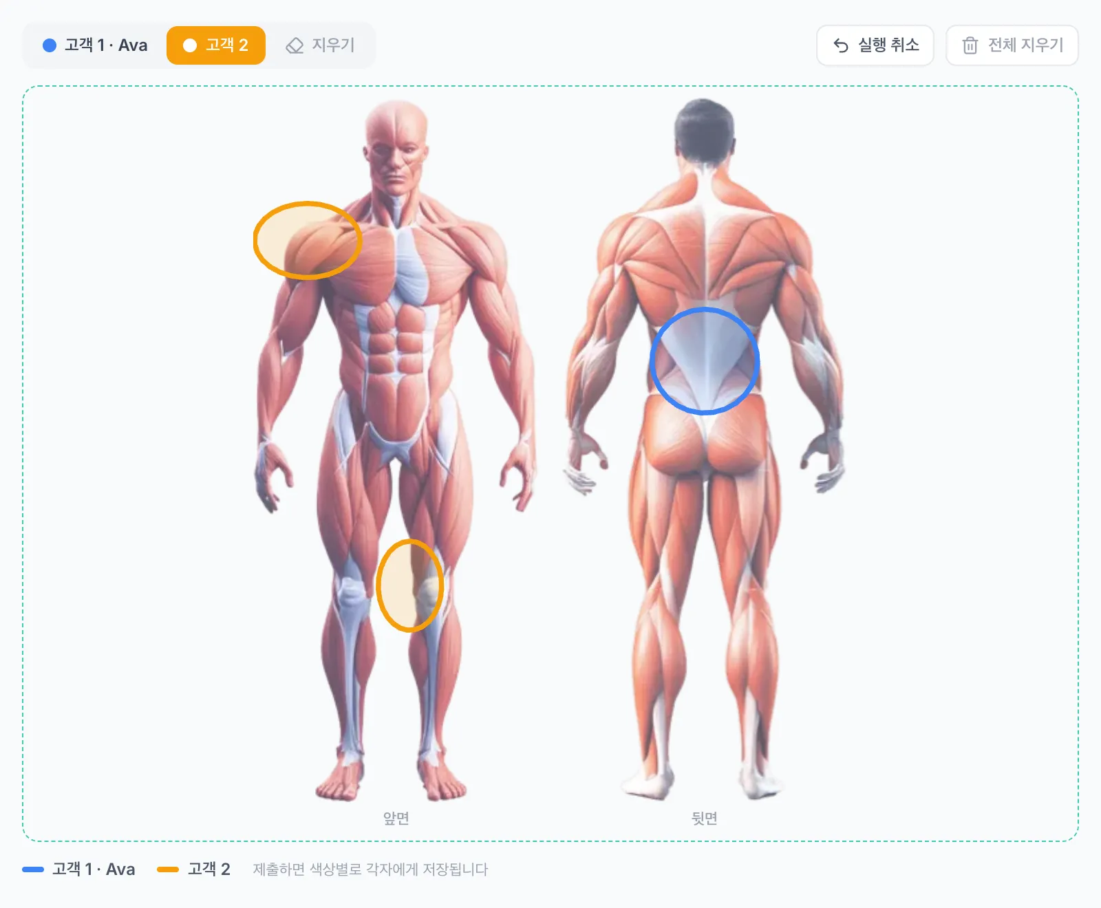 하나의 바디 다이어그램에 파란색과 주황색 펜 표시가 있는 커플 체크인 양식